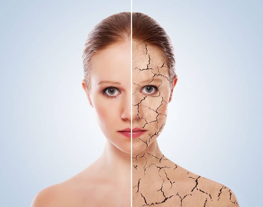Gesunde und von Psoriasis betroffene Haut
